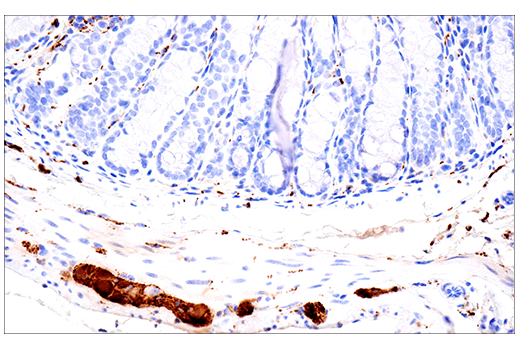 Immunohistochemistry Image 12: Calretinin (E7R6O) Rabbit Monoclonal Antibody