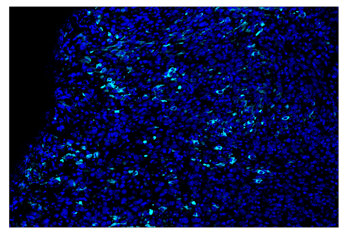 Immunohistochemistry Image 1: iNOS (E1W4J) & CO-0179-488 SignalStar<sup>™</sup> Oligo-Antibody Pair