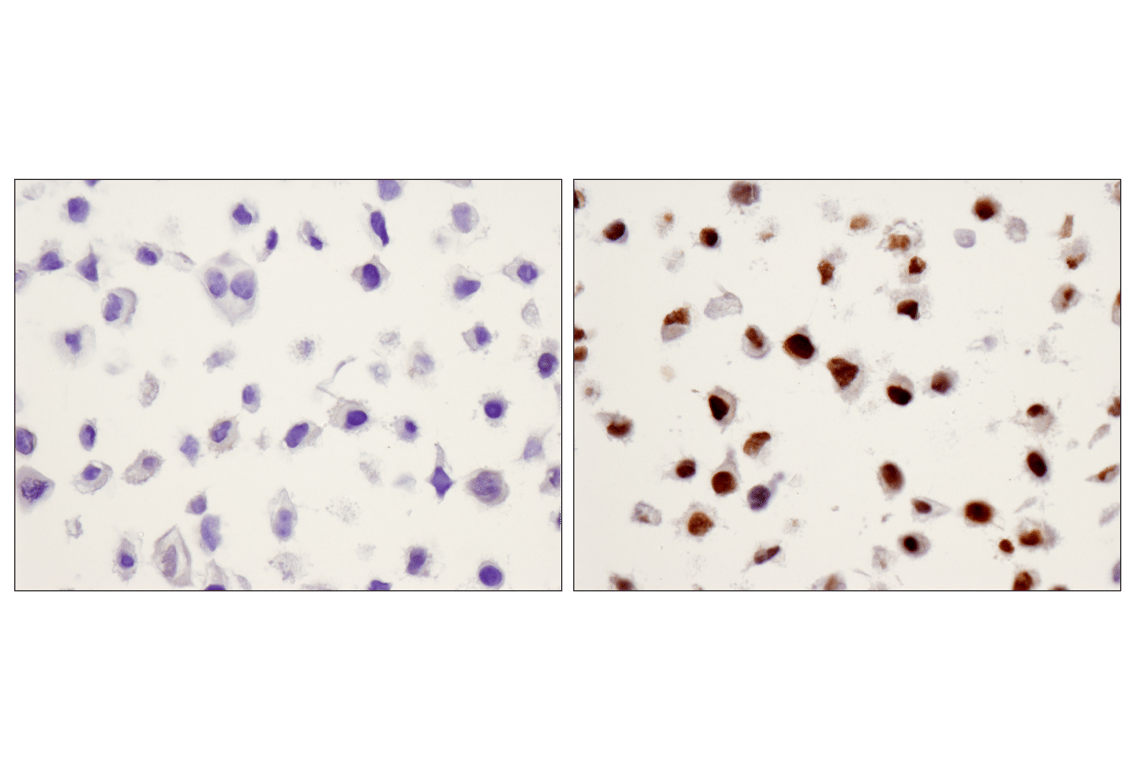Immunohistochemistry Image 4: Phospho-Stat3 (Tyr705) (D3A7) XP<sup>®</sup> Rabbit mAb (BSA and Azide Free)