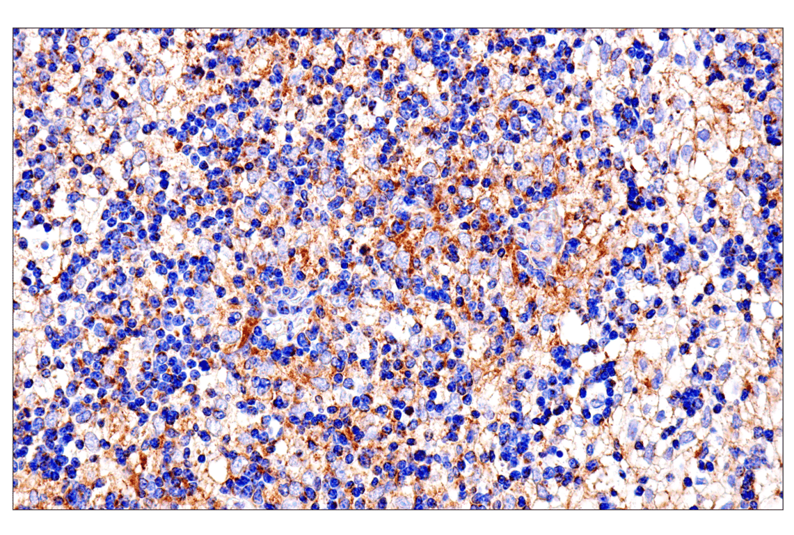 Immunohistochemistry Image 2: SLC25A1 (E7B2B) Rabbit Monoclonal Antibody