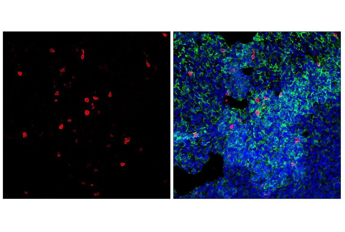Immunofluorescence Image 1: PD-1 (Intracellular Domain) (D7D5W) Rabbit Monoclonal Antibody