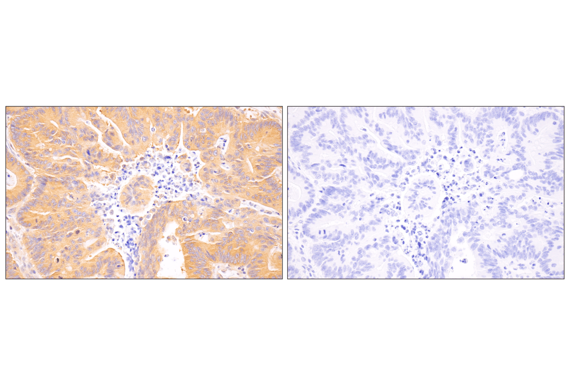 undefined Image 30: PPAR gamma Regulated Fatty Acid Metabolism Antibody Sampler Kit