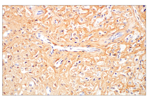 Immunohistochemistry Image 4: COL14A1 (E5W8S) Rabbit Monoclonal Antibody