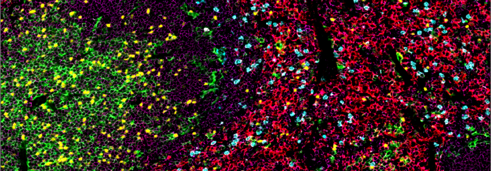 SignalStar™ multiplex immunohistochemical analysis of paraffin-embedded mouse spleen using CD45 (D3F8Q) & CO-0046-488 SignalStar™ Oligo-Antibody Pair #72790 (magenta), FoxP3 (D6O8R) & CO-0041-647 SignalStar™ Oligo-Antibody Pair #45142 (yellow), Ly-6G (E6Z1T) & CO-0053-750 SignalStar™ Oligo-Antibody Pair #64664 (cyan), CD8α (D4W2Z) & CO-0040-594 SignalStar™ Oligo-Antibody Pair #39714 (green), F4/80 (D2S9R) & CO-0042-488 SignalStar™ Oligo-Antibody Pair #95804 (red), and Granzyme B (E5V2L) & CO-0049-647 SignalStar™ Oligo-Antibody Pair #98534 (white). All fluorophores have been assigned a pseudocolor, as indicated. Staining was performed on the BOND RX autostainer by Leica Biosystems.