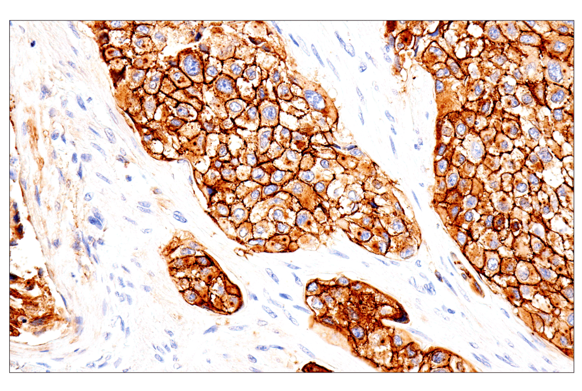 Immunohistochemistry Image 7: Syndecan 1 (E7F7T) Rabbit Monoclonal Antibody (BSA and Azide Free)