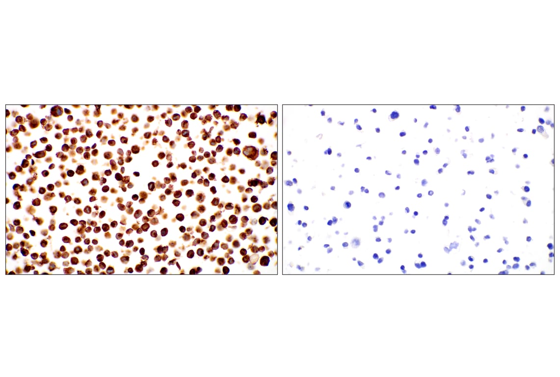 Immunohistochemistry Image 9: Cathepsin L (E3R3P) Rabbit Monoclonal Antibody
