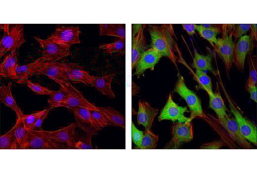 Immunofluorescence Image 1: Phospho-NDRG1 (Thr346) (D98G11) Rabbit Monoclonal Antibody