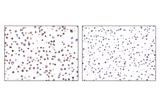 Immunohistochemistry Image 2: IDH2 (D8E3B) Rabbit Monoclonal Antibody