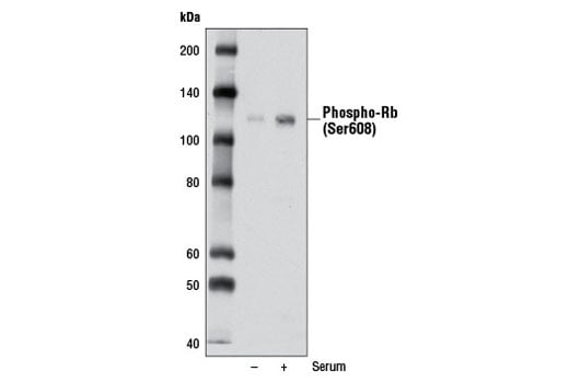 Western Blotting Image 2: Phospho-Rb (Ser608) (D10F2) Rabbit Monoclonal Antibody