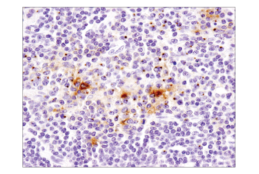 Immunohistochemistry Image 1: CD40 Ligand (D5J9Y) Rabbit Monoclonal Antibody (BSA and Azide Free)
