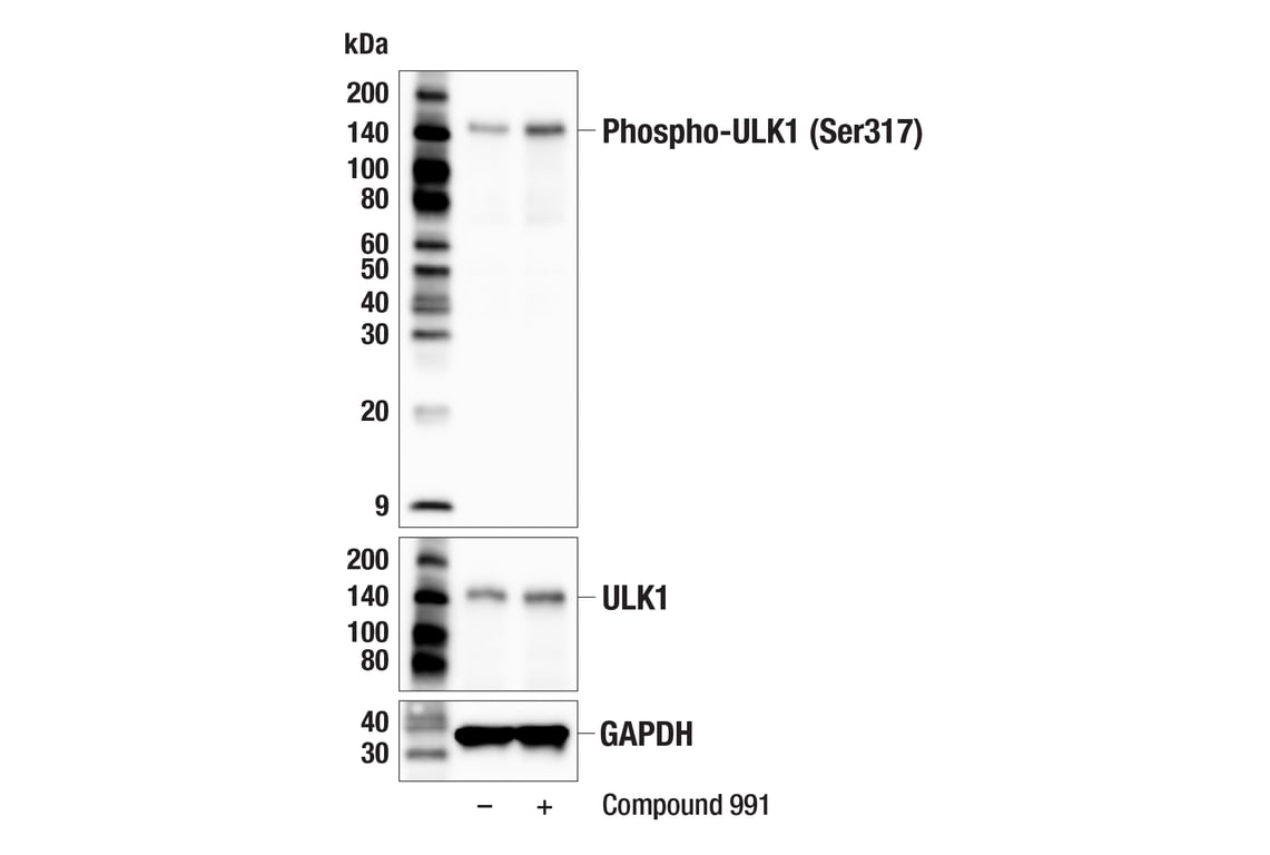 Western Blotting Image 1: Phospho-ULK1 (Ser317) (F1Z6C) Rabbit mAb