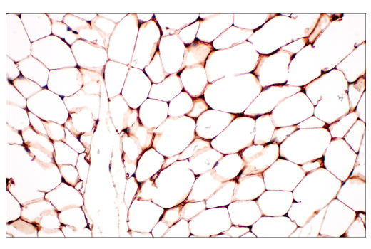 Immunohistochemistry Image 2: CD36 (E8B7S) Rabbit Monoclonal Antibody