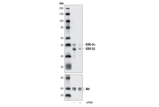 undefined Image 16: Alzheimer's Disease Antibody Sampler Kit