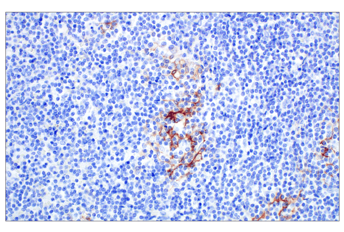 Immunohistochemistry Image 1: MAdCAM-1 (E1V8F) Rabbit Monoclonal Antibody (BSA and Azide Free)