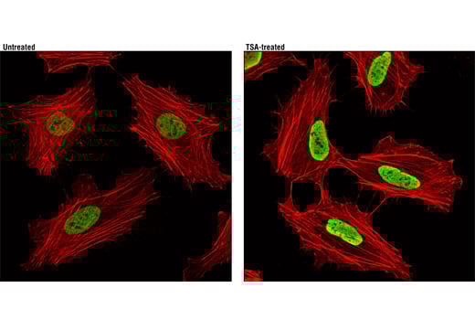 Immunofluorescence Image 1: Acetyl-Histone H3 (Lys27) (D5E4) Rabbit Monoclonal Antibody (BSA and Azide Free)