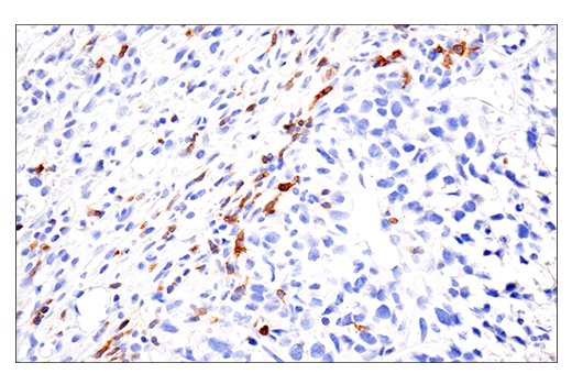 Immunohistochemistry Image 2: GITR (E9O9H) Rabbit Monoclonal Antibody (BSA and Azide Free)