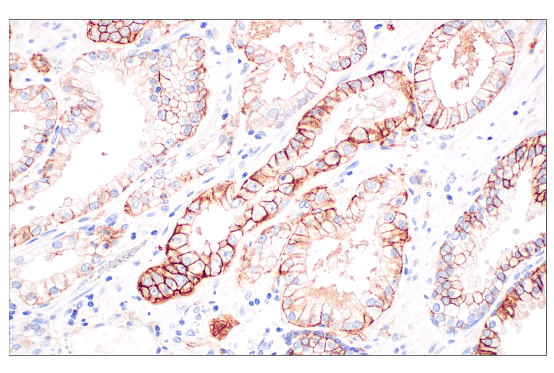 Immunohistochemistry Image 1: MCT1/SLC16A1 (E7A2K) Rabbit Monoclonal Antibody
