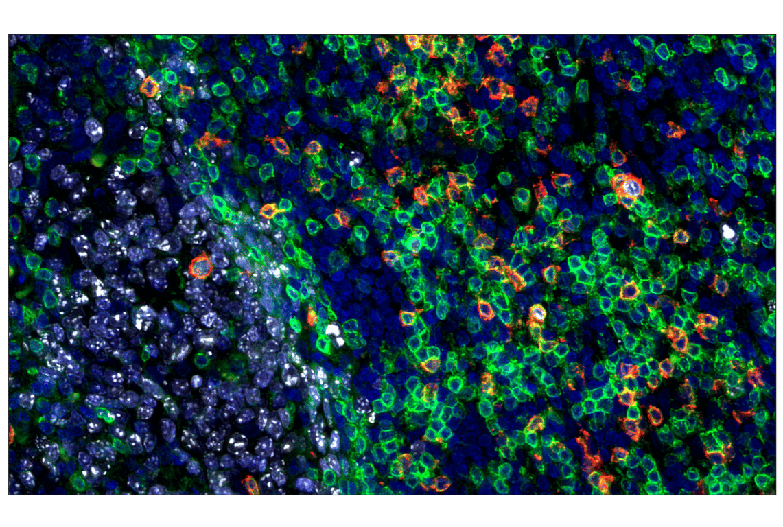 Immunohistochemistry Image 2: Ki-67 (D2H10) Rabbit Monoclonal Antibody (Alexa Fluor<sup>®</sup> 555 Conjugate)