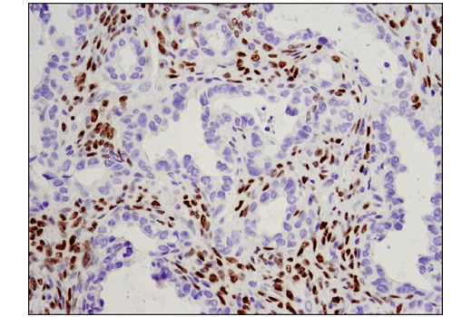 Immunohistochemistry Image 4: WT1 (D8I7F) Rabbit Monoclonal Antibody (BSA and Azide Free)