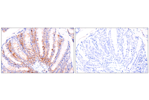 Cathepsin D (E7Z4L) XP® Rabbit mAb (BSA and Azide Free) | Cell