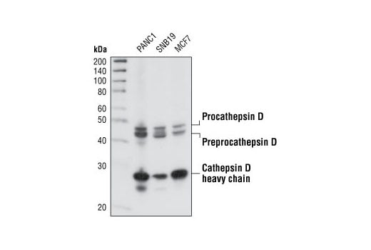 Western Blotting Image 1: Cathepsin D Antibody