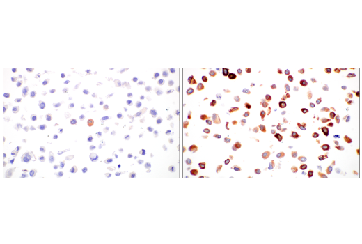Immunohistochemistry Image 11: HO-1 (E8B7A) Rabbit Monoclonal Antibody