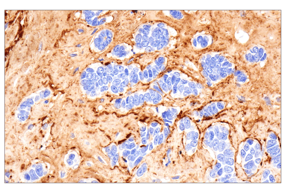 Immunohistochemistry Image 2: Vitronectin (F8D3L) Rabbit Monoclonal Antibody