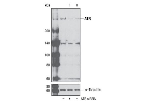 undefined Image 2: SignalSilence<sup>®</sup> ATR siRNA I
