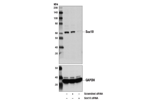 Western Blotting Image 2: Sox10 Antibody