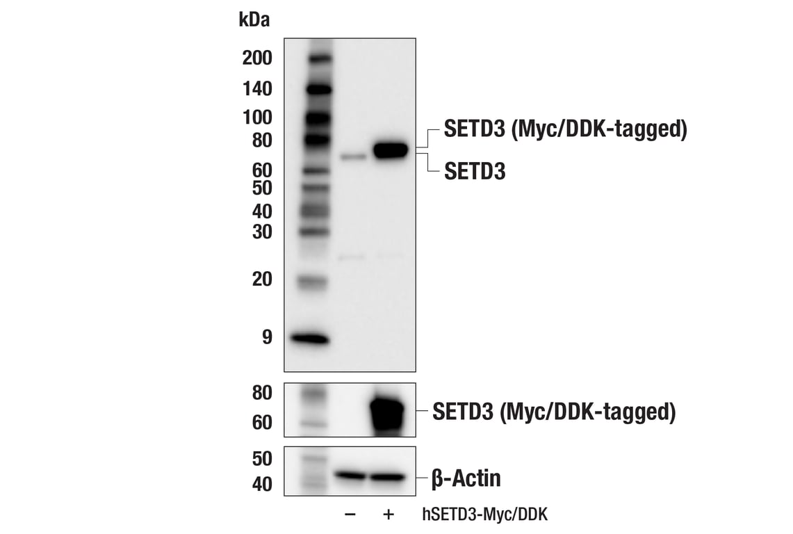 Western Blotting Image 2: SETD3 (E3U6D) Rabbit Monoclonal Antibody