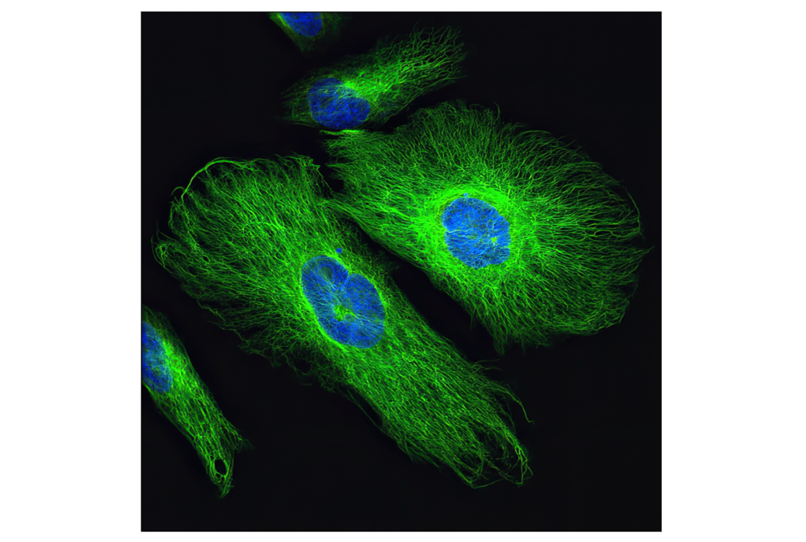 Immunofluorescence Image 1: Vimentin (D21H3) Rabbit Monoclonal Antibody