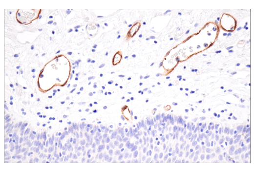Immunohistochemistry Image 5: CD62P/P-Selectin (E8Q1W) Rabbit Monoclonal Antibody