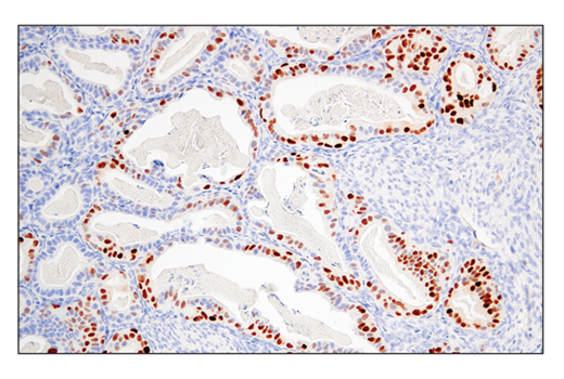 Immunohistochemistry Image 1: Cyclin D1 (E3P5S) Rabbit Monoclonal Antibody (BSA and Azide Free)