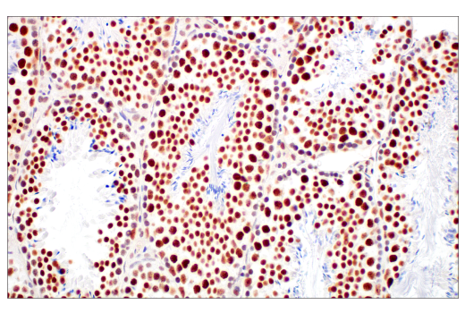Immunohistochemistry Image 10: XRCC1 (E4A3V) Rabbit Monoclonal Antibody