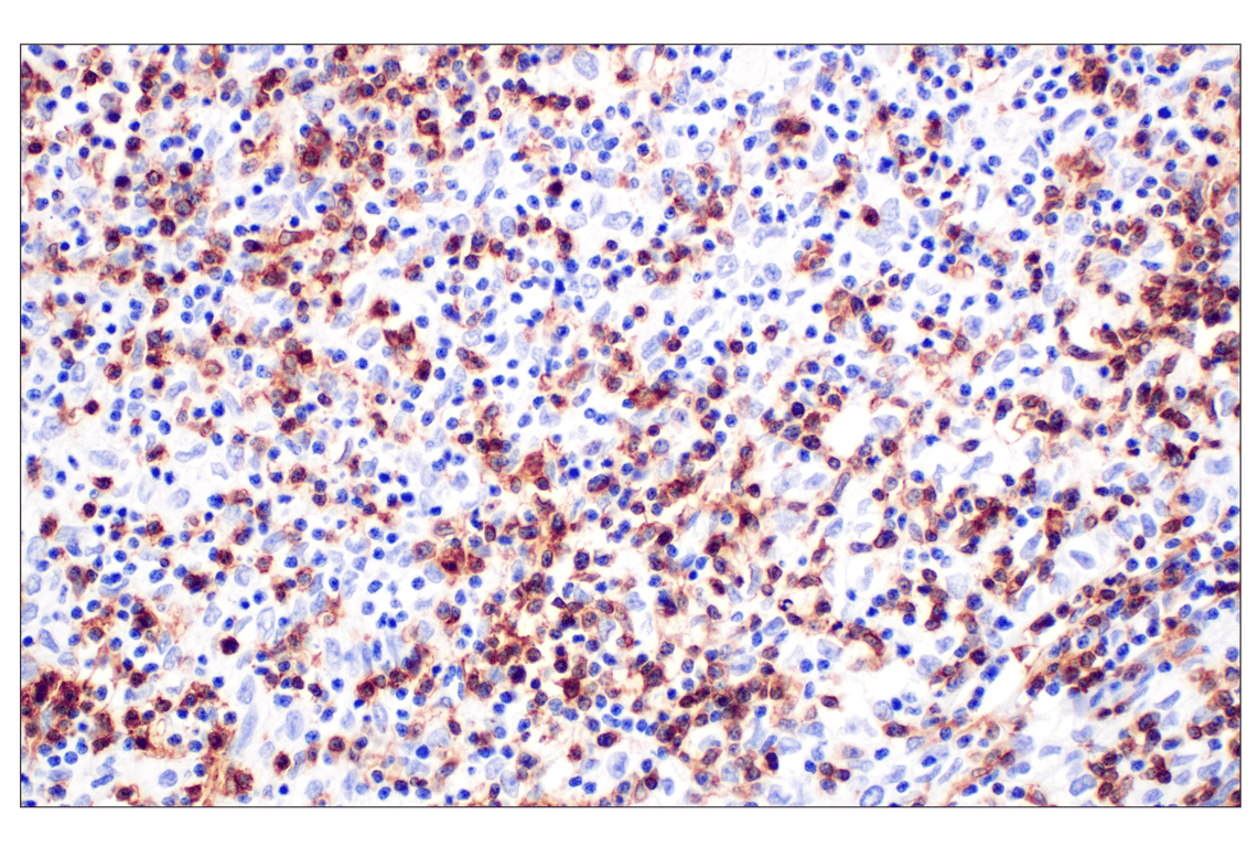 Immunohistochemistry Image 1: CD4 (MSVA-004R) Rabbit Monoclonal Antibody