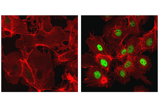 Immunofluorescence Image 1: HIF-1 alpha (D1S7W) Rabbit Monoclonal Antibody (BSA and Azide Free)