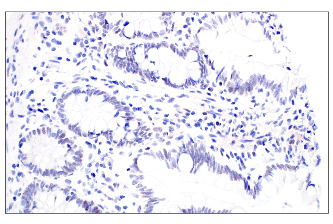 Immunohistochemistry Image 7: MDM2 (F7W7X) Rabbit Monoclonal Antibody (BSA and Azide Free)