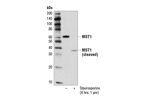 Western Blotting Image 2: MST1 (D8B9Q) Rabbit Monoclonal Antibody