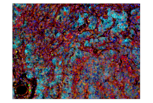 Immunohistochemistry Image 5: LAG3 (D2G4O) Rabbit Monoclonal Antibody (BSA and Azide Free)