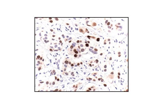 undefined Image 11: Phospho-p53 Antibody Sampler Kit