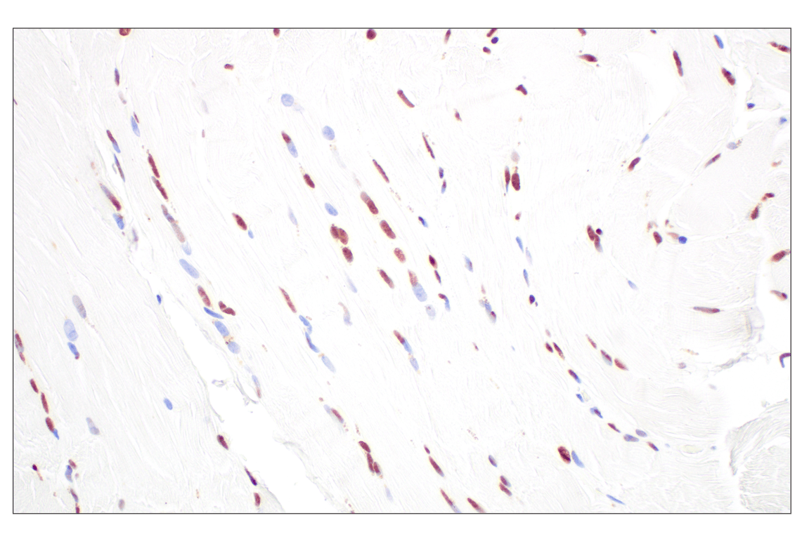 Immunohistochemistry Image 5: CBX7 (E7N1W) Rabbit Monoclonal Antibody
