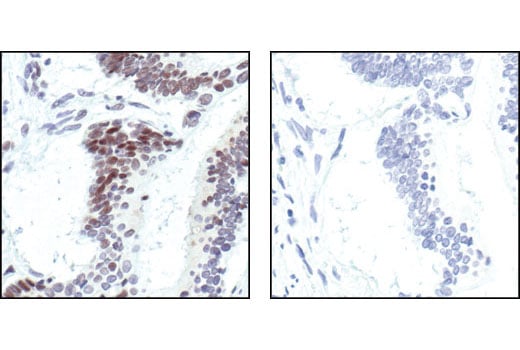 Immunohistochemistry Image 1: FoxO3a Antibody
