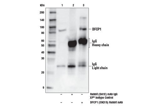 Immunoprecipitation Image 1: DFCP1 (E9Q1S) Rabbit Monoclonal Antibody