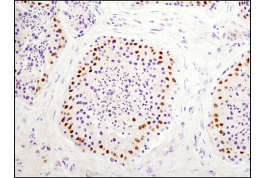 Immunohistochemistry Image 3: DAX1 (D2F1) Rabbit Monoclonal Antibody
