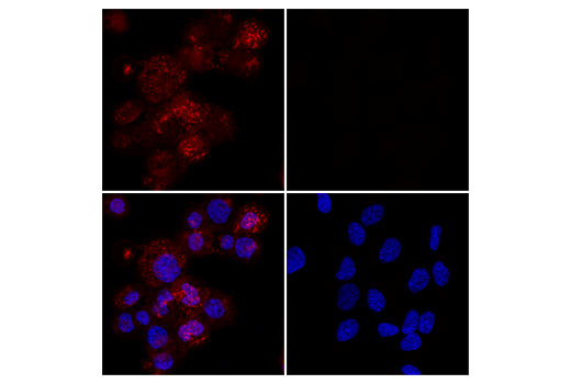 Iba1/AIF-1 (E4O4W) XP® Rabbit mAb (Alexa Fluor® 594 Iba1/AIF-1 (E4O4W) XP® Rabbit mAb (Alexa Fluor® 594