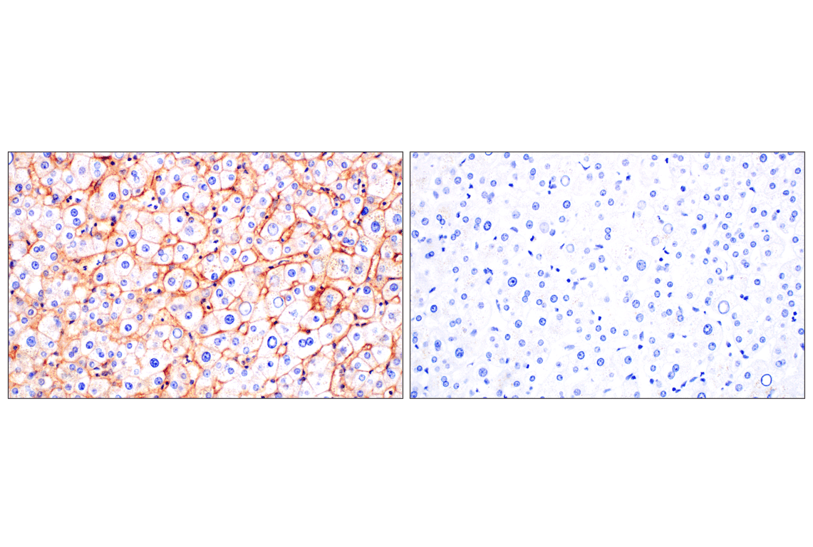 Immunohistochemistry Image 9: SCARB1 (E9H4F) Rabbit Monoclonal Antibody