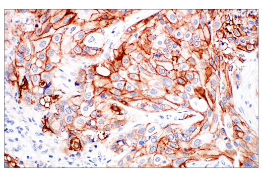 Immunohistochemistry Image 1: Integrin beta6 (E4M9P) Rabbit Monoclonal Antibody