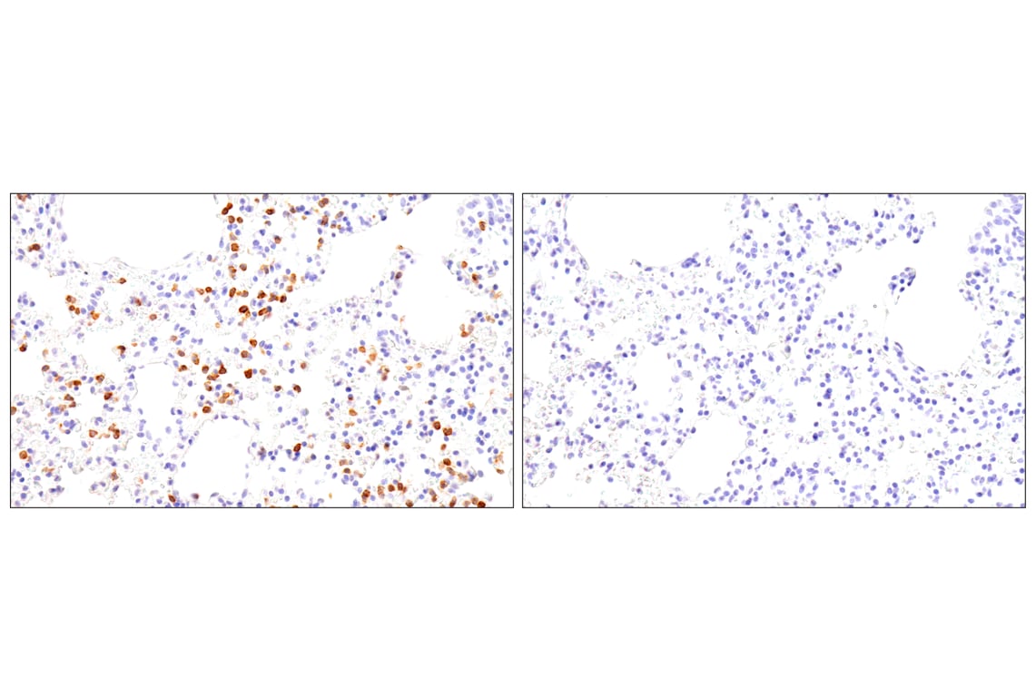 Immunohistochemistry Image 7: CD62L/L-Selectin (E7L2M) Rabbit Monoclonal Antibody