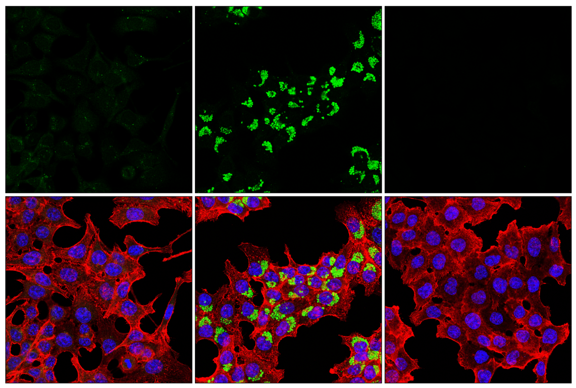 Immunofluorescence Image 1: LC3B (E5Q2K) Mouse Monoclonal Antibody (BSA and Azide Free)