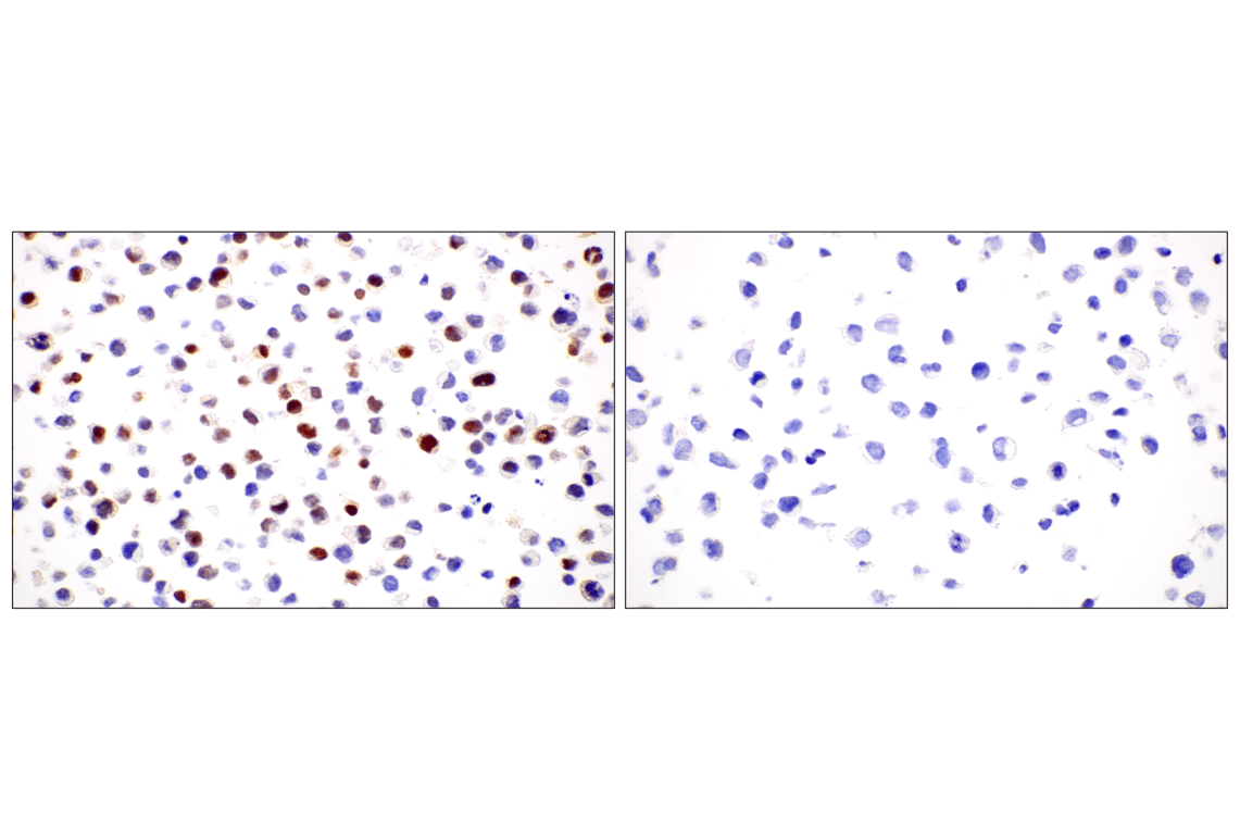 Immunohistochemistry Image 8: KLF2 (E7K8Y) Rabbit Monoclonal Antibody (BSA and Azide Free)